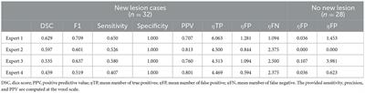 Editorial: Automatic methods for multiple sclerosis new lesions detection and segmentation